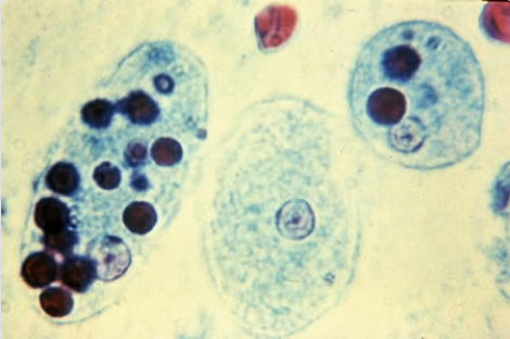 <p>(10-20 um): 1 nucleus, small central karyosome with even chromatin, RBC’s cytoplasmic inclusion</p>