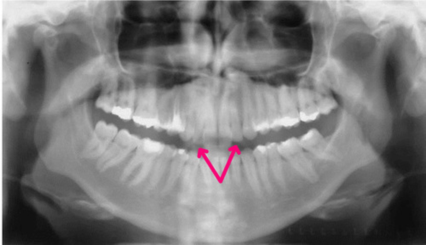 <p>Identify the structure.</p>