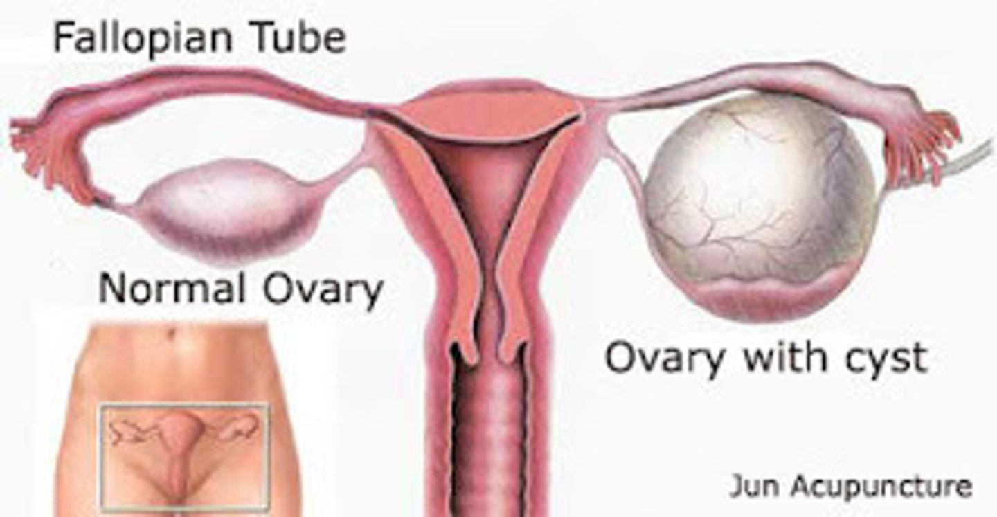 <p>related to ovary</p>