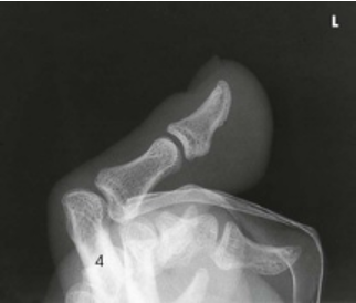term image