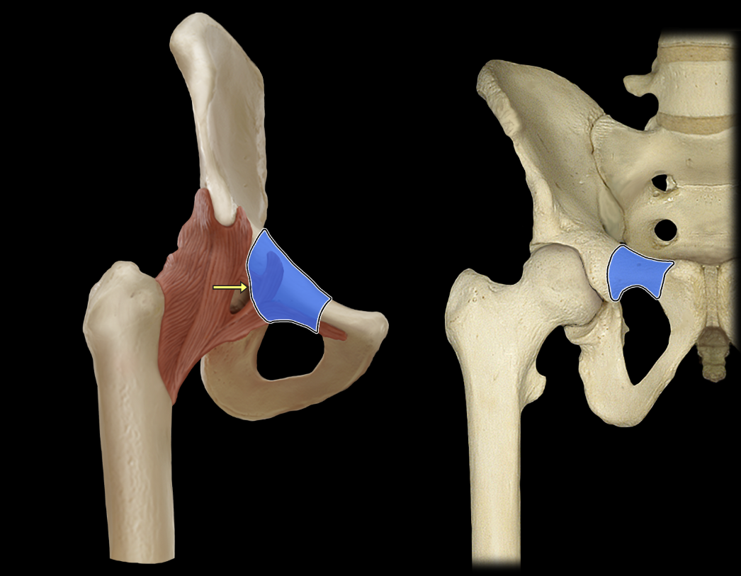 <p>Superior pubic ramus</p>