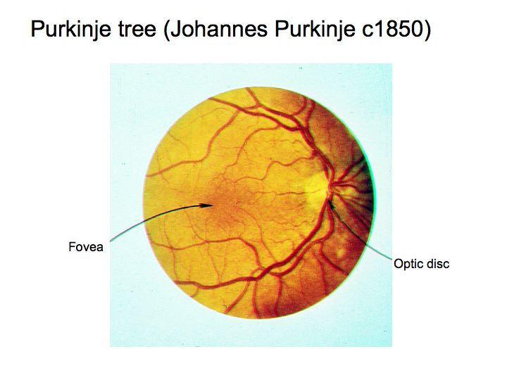 <p>Close eyes, hold light next to eyelid at 45º angle and move it from side to side. The branching image is the Purkinje tree</p>