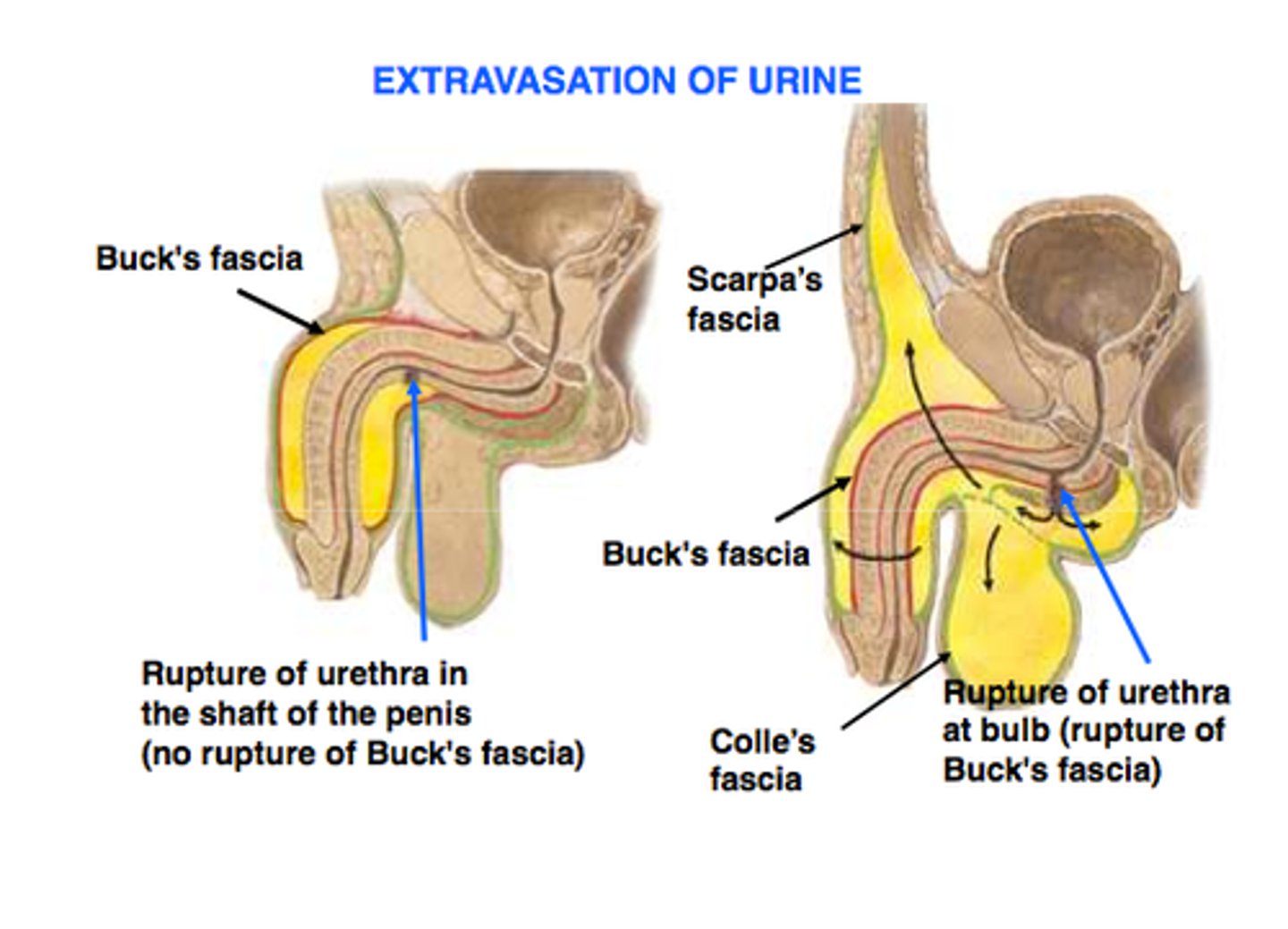 <p>straddle injury (males)</p>