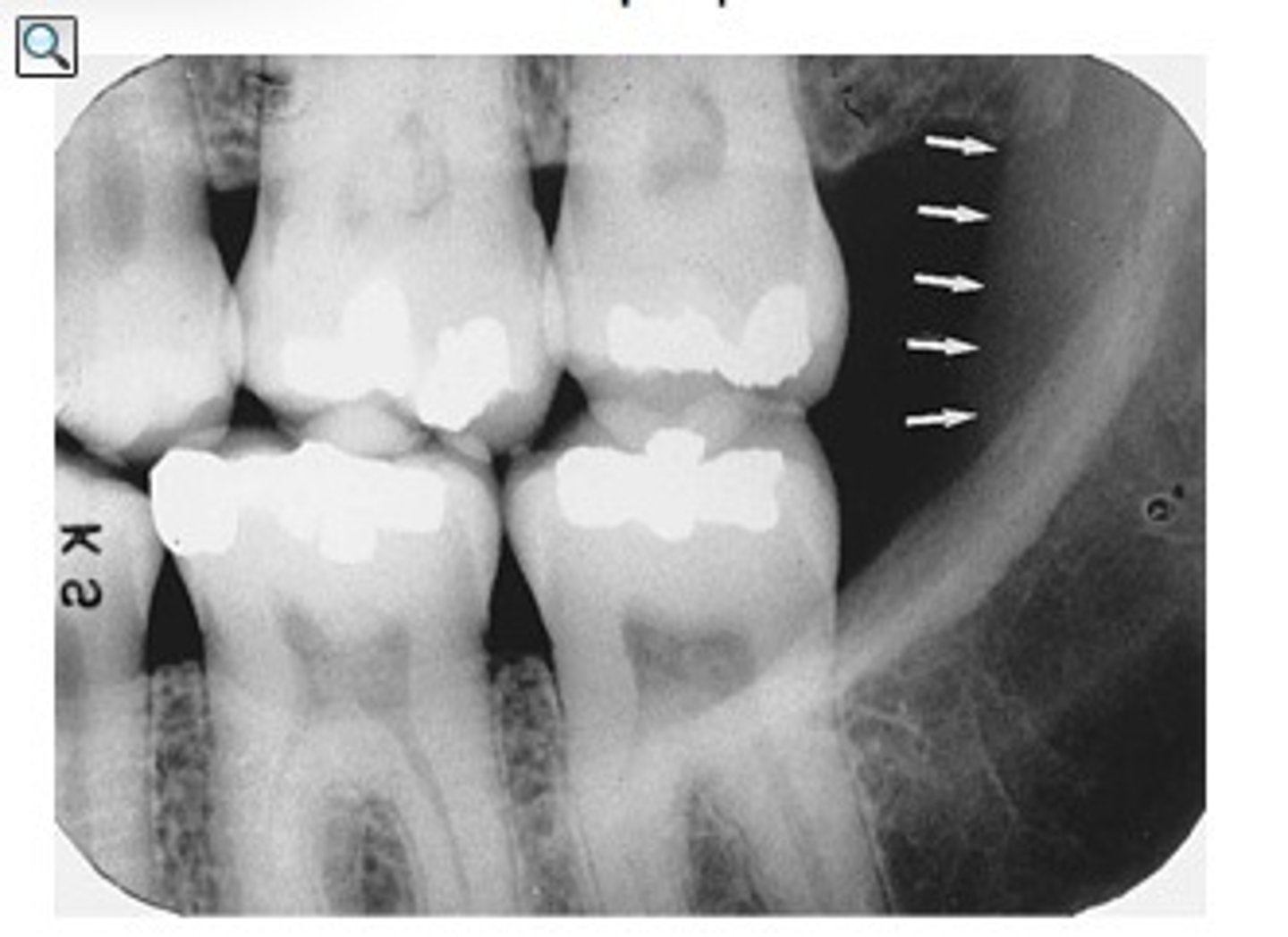 <p>Identify the radiopaque structure</p>