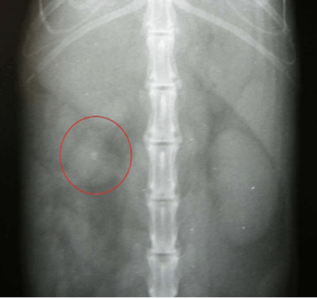 <p>NO, es poco específica.</p><p>hay cambios muy generales:</p><p>- ↑ contraste abd</p><p>- redistribución de grasa abd, hepatomegalia, distensión vesical</p><p>- masa/calcificación adrenal</p>