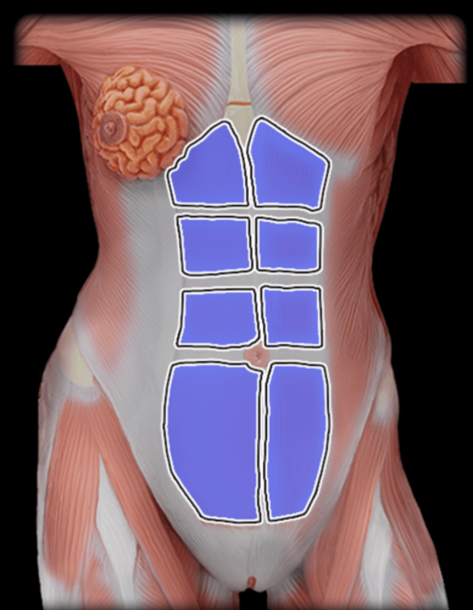 <p>What Muscle Is Highlighted?</p>