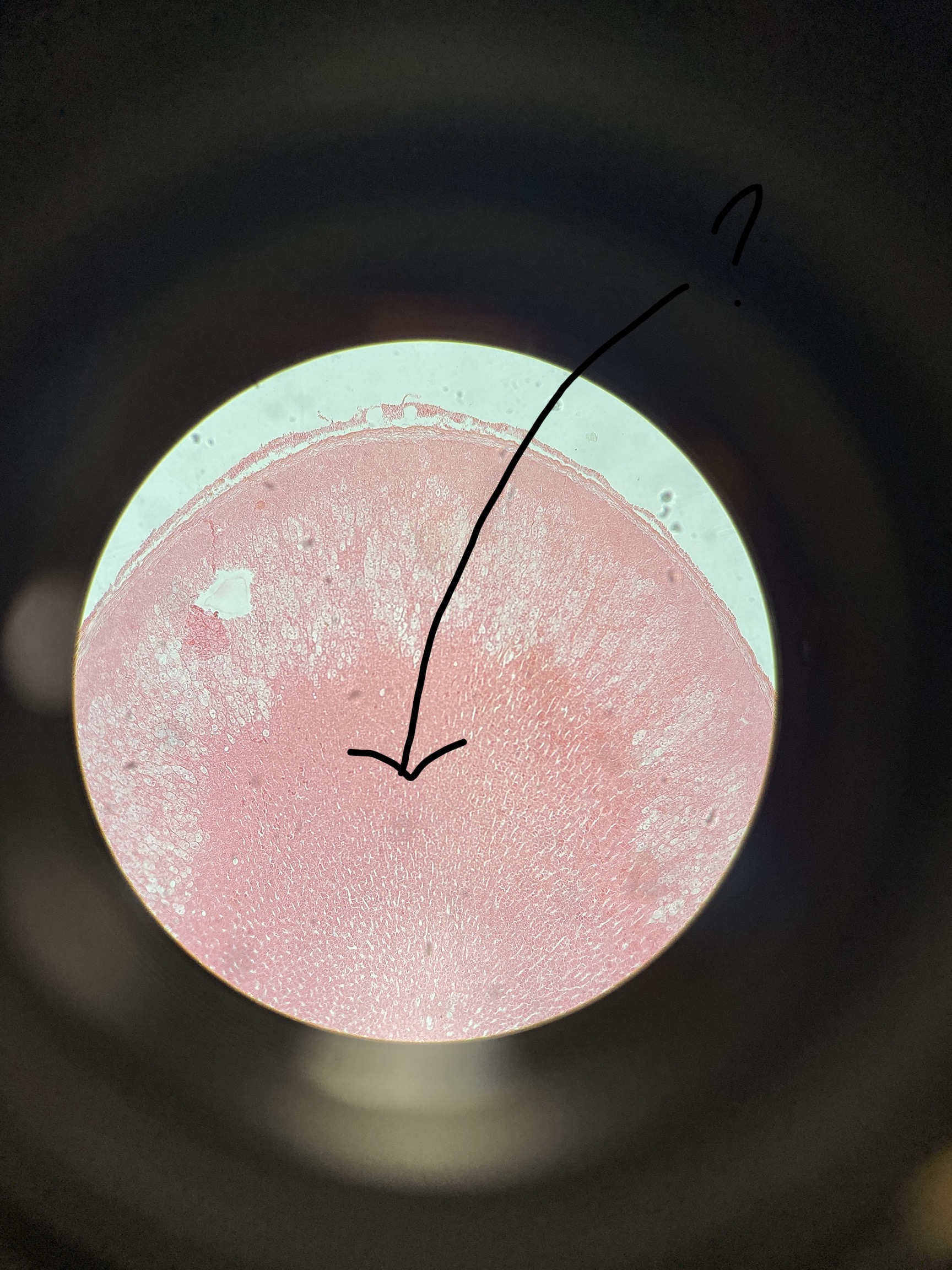<p>What is the arrow pointing to?</p>