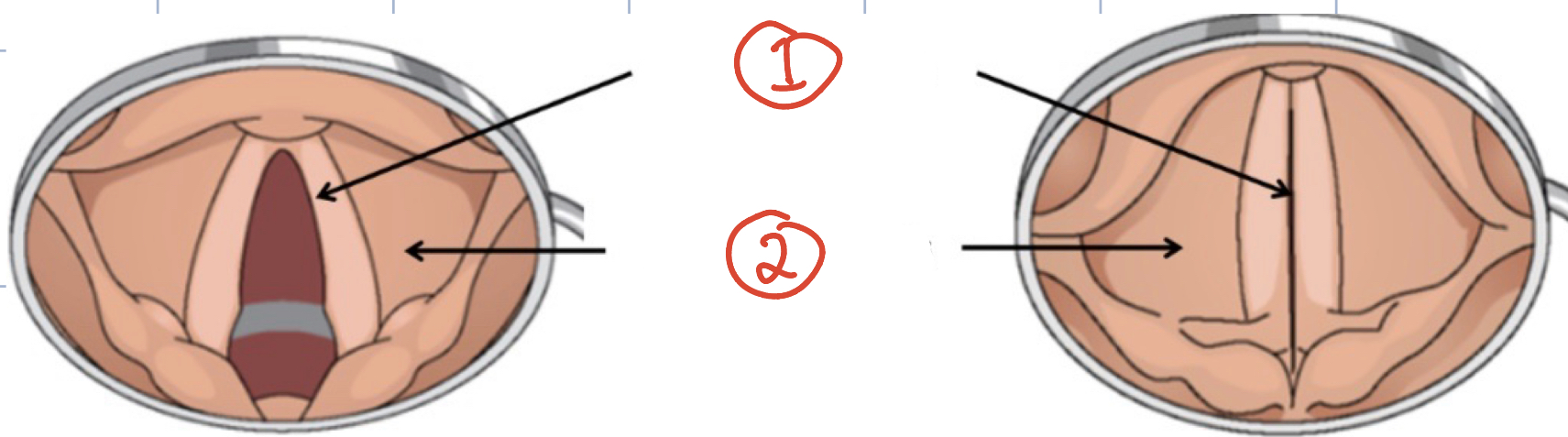 term image