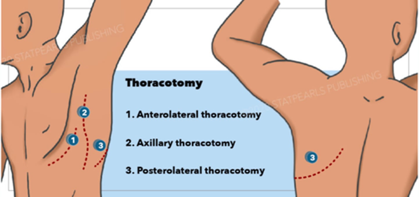 <p>Minimally Invasive Cardiac Procedures And Epicardial Pacemaker Placement</p>