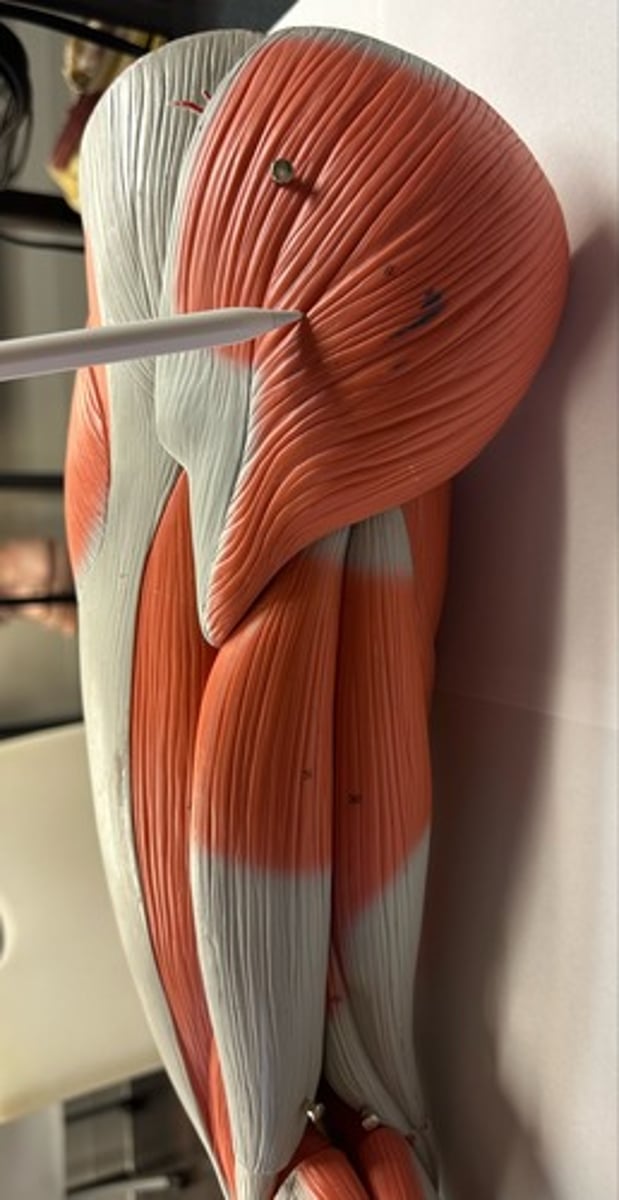<p>What are the (4) attachments of the Gluteus Maximus?</p>