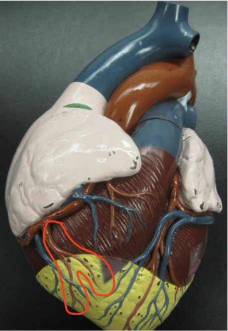 <p>branch extending down from the right coronary artery</p>
