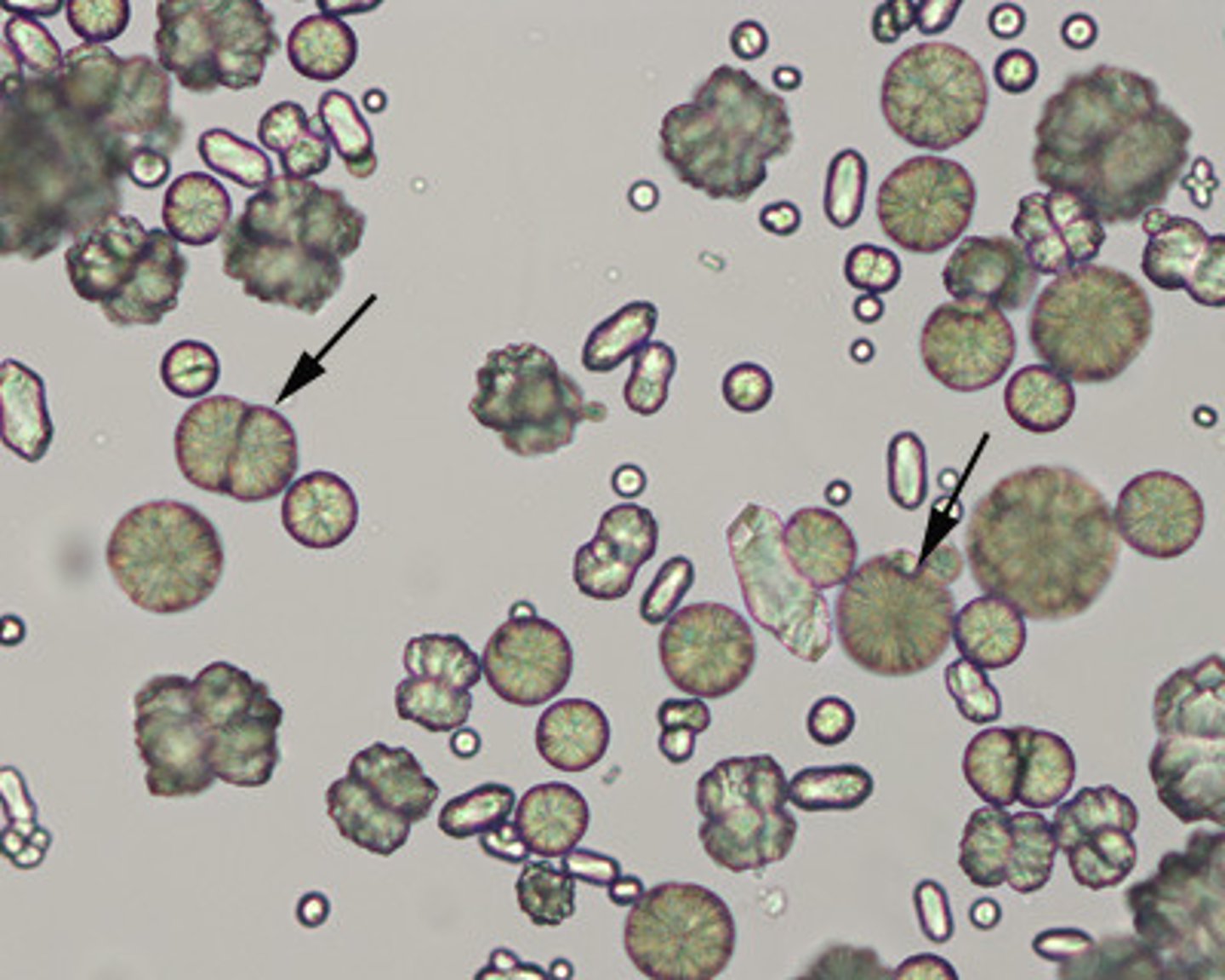 <p>- Alkaline pH &lt;8.0</p><p>- Colorless (dumbbells)</p><p>- Resemble amorphous material, but can be distinguished by producing gas after the addition of acetic acid.</p><p>- No clinical significance</p>