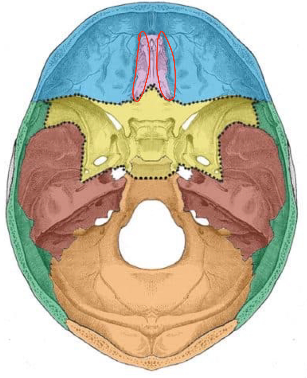 term image