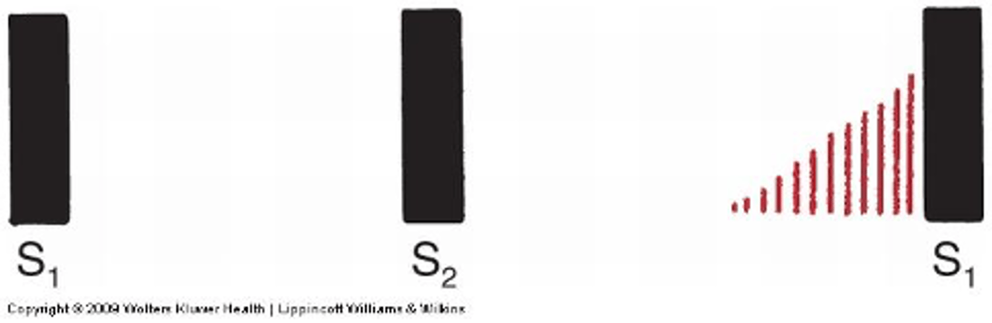 <p>Stars soft and gets louder:</p>