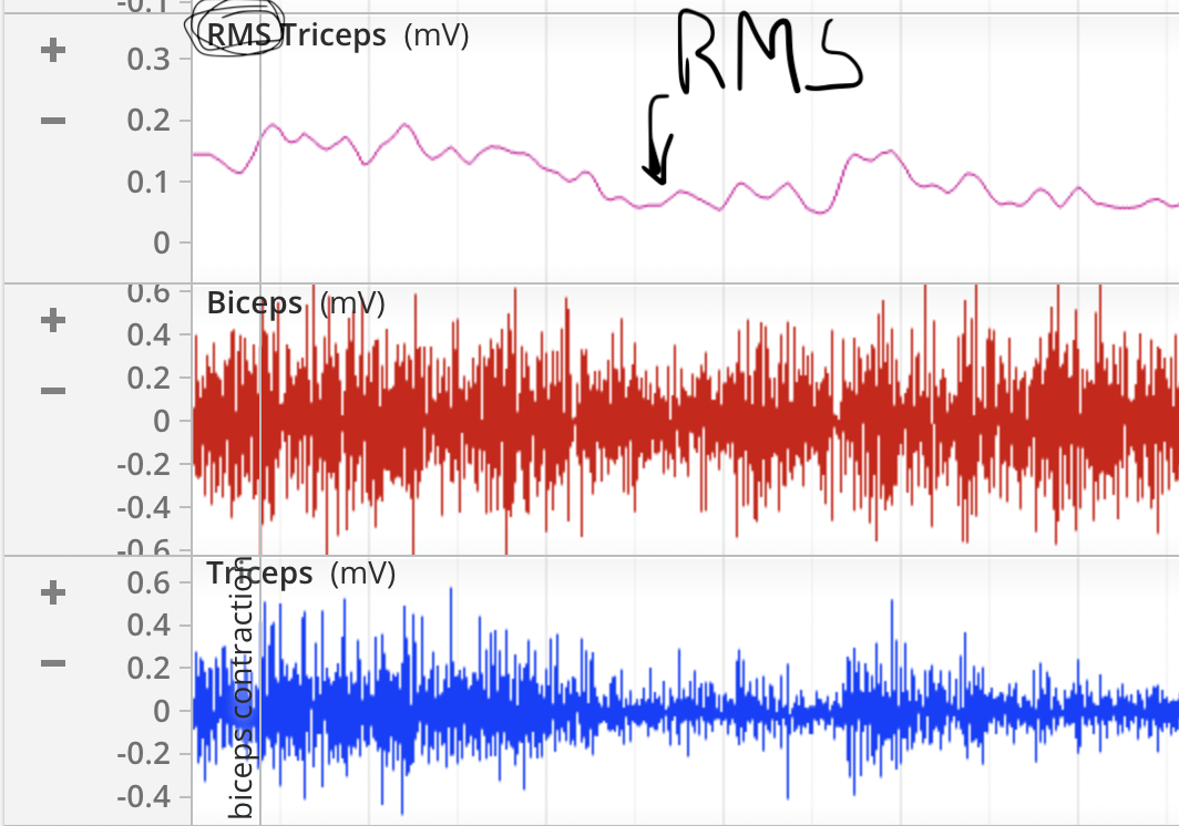 <p>In EMGs the muscles <strong>RMS</strong> graph = _______ data</p>