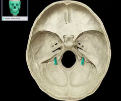 <p>Name this foramen.</p>