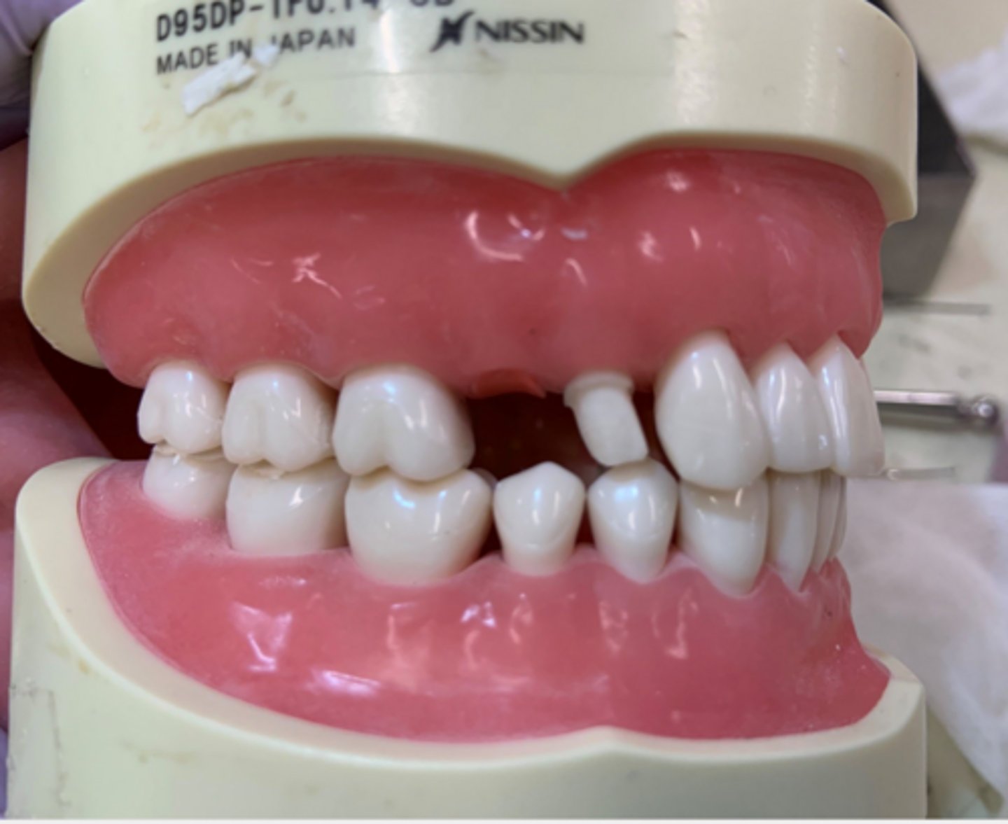 <p>What is wrong with the tooth prep on #5?</p>