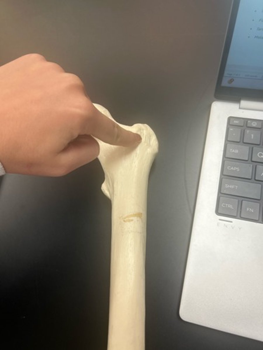 <p>name the bone</p>