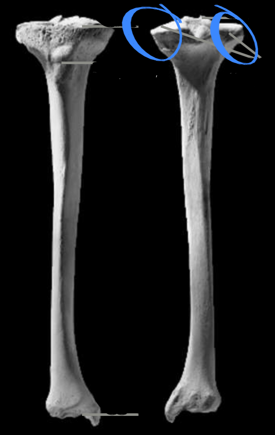 <p>Femur alignment, located on the tibia</p>