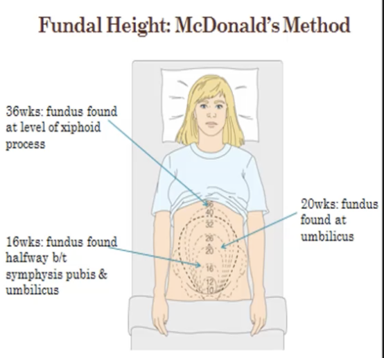 <p>Measuring from the pubic symphysis to the top of the fundus</p><p>Correlates with gestational age + or - 2cm</p>