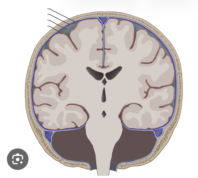 <p>Lable these sections </p>
