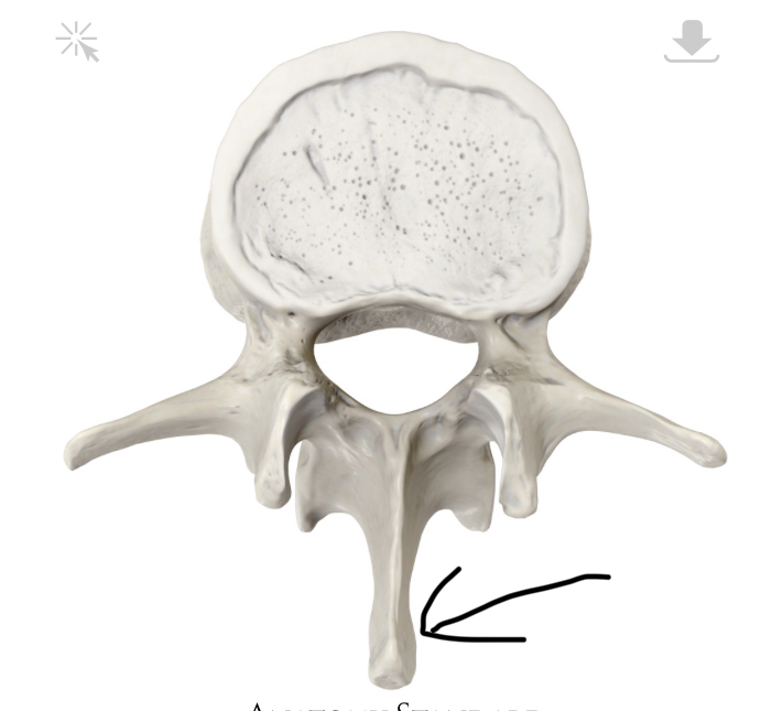 <p>Hoe heet dit botpunt?</p>