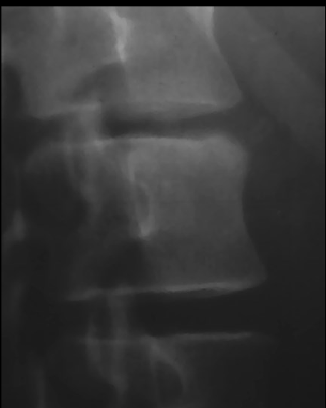 <p>what is seen here?</p>