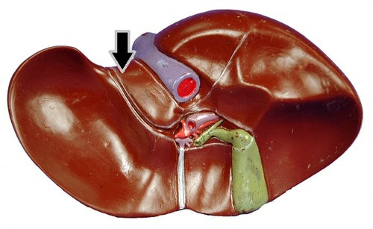 <p>What part of the liver is this?</p>