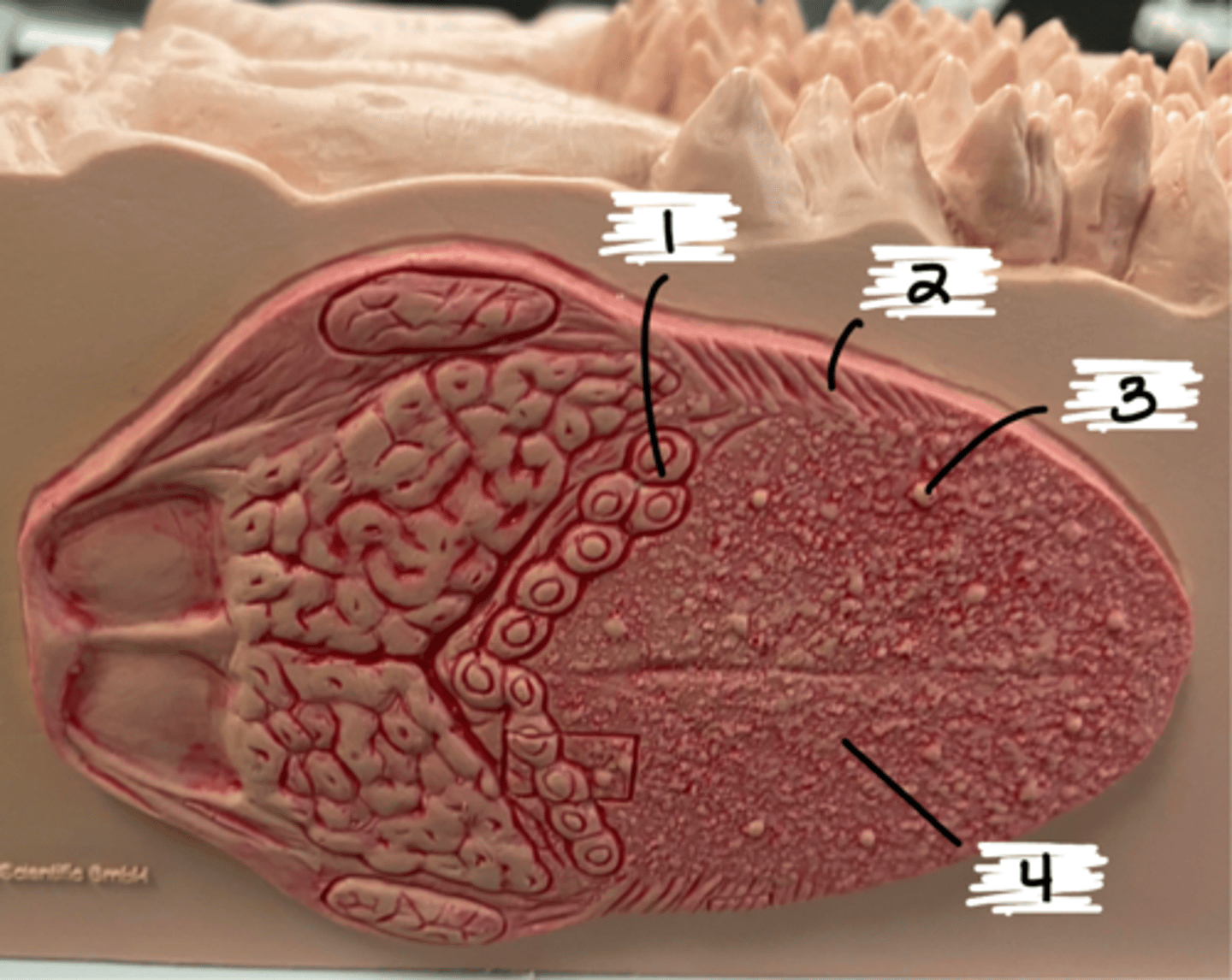 <p>what type of papillae is 4</p>