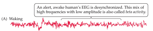 <p>Beta waves (high frequency, low amplitude), <strong>desynchronized EEG</strong>.</p>