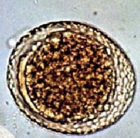 <p>LARGE egg with golf ball type pitting of wall</p>