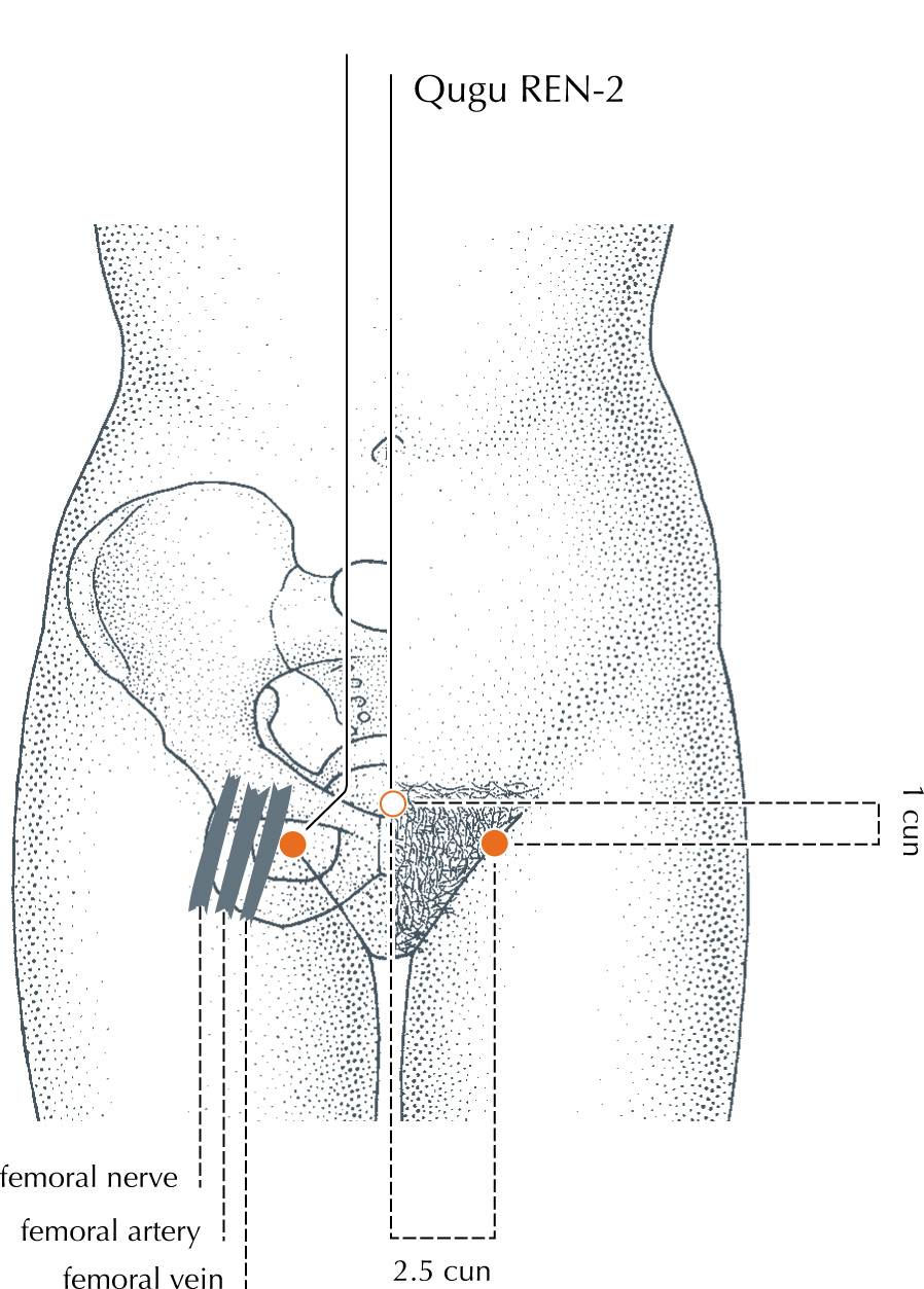 <p>LV-12</p>