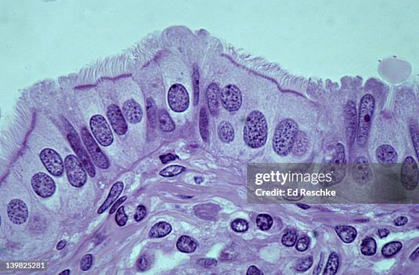 <p>Simple Columnar Epithelium Cells (Ciliated)</p>