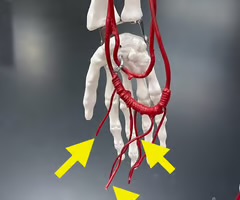 <p>Name the blood vessel.</p>