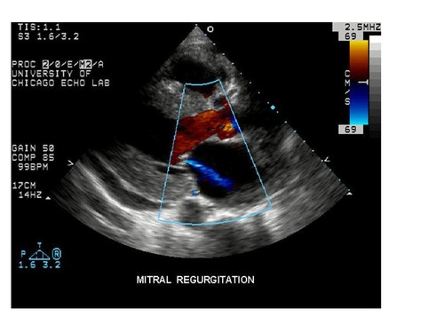 <p>flow away from the transducer</p>