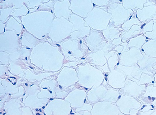 DESCRIPTION: matrix as in areolar, but vary sparse; with closely packed fat cells (adipocytes); nucleus pushed to side by fat droplet
FUNCTION: provides reserve fuel; insulates against heat loss; supports and protects organs
LOCATION: under skin, around kidneys & eyeballs, within abdomen, and breasts