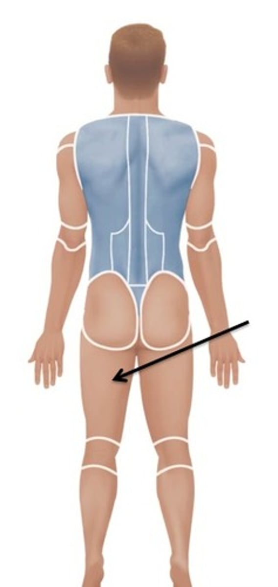<p>back of thigh</p>