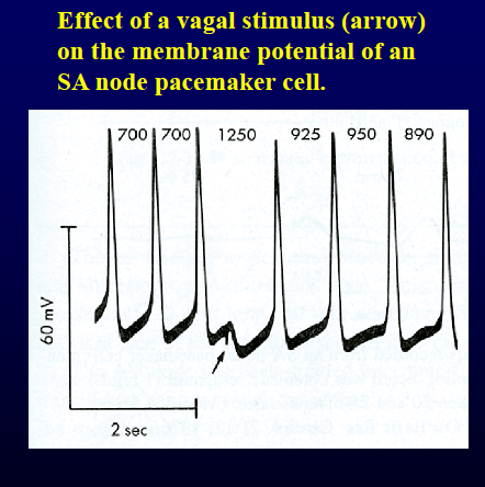 <p>acetylcholine; diminishes; hyperpolarizing Vm and reducing slope of the pacemaker potential </p>