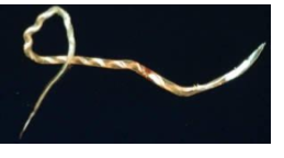 <p>barber pole worm</p>