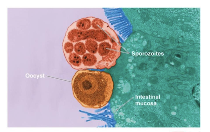 <ul><li><p>digestive protozoal disease</p><ul><li><p>leading cause of recreational waterborne disease outbreaks</p></li></ul></li><li><p>cause: <em>Cryptosporidium hominis</em>, <em>C. parvum</em></p><ul><li><p>virulence: opportunistic; chlorination resistance</p></li></ul></li><li><p>transmission: ingestion of oocysts that mature into sporozoites</p></li><li><p>symptoms: mild, self-limited profuse diarrhea</p></li></ul><p></p>