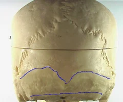 <p>(top blue line) posterior view</p>