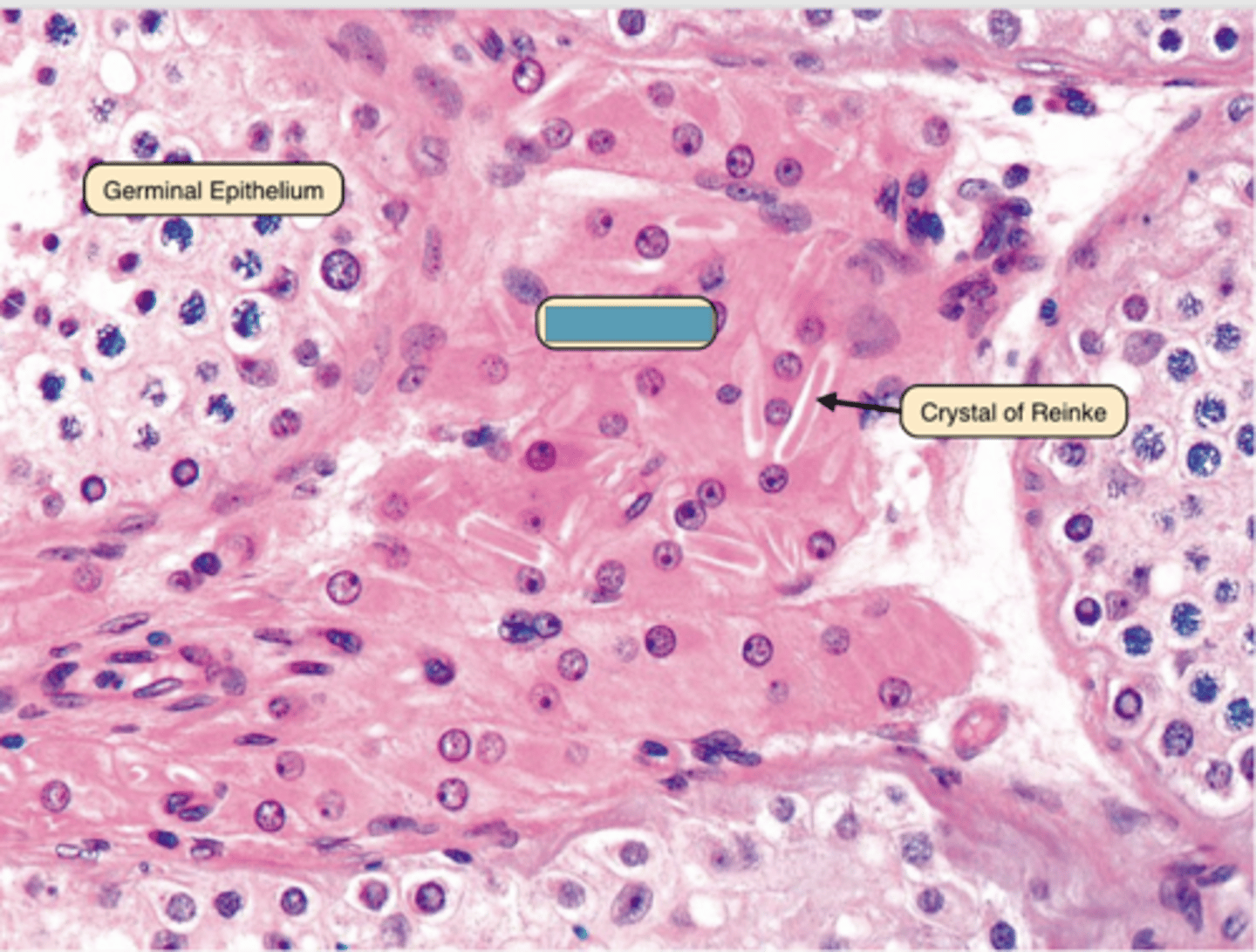 <p>Identify the cells</p>