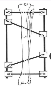 <p>Linear type 2 ESF</p>
