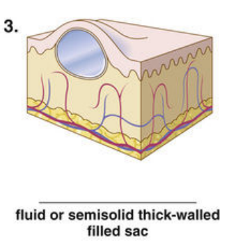 <p><span style="color: red">F Match each of the following lesions with their illustrations in Figure 16-26.</span></p><p></p>