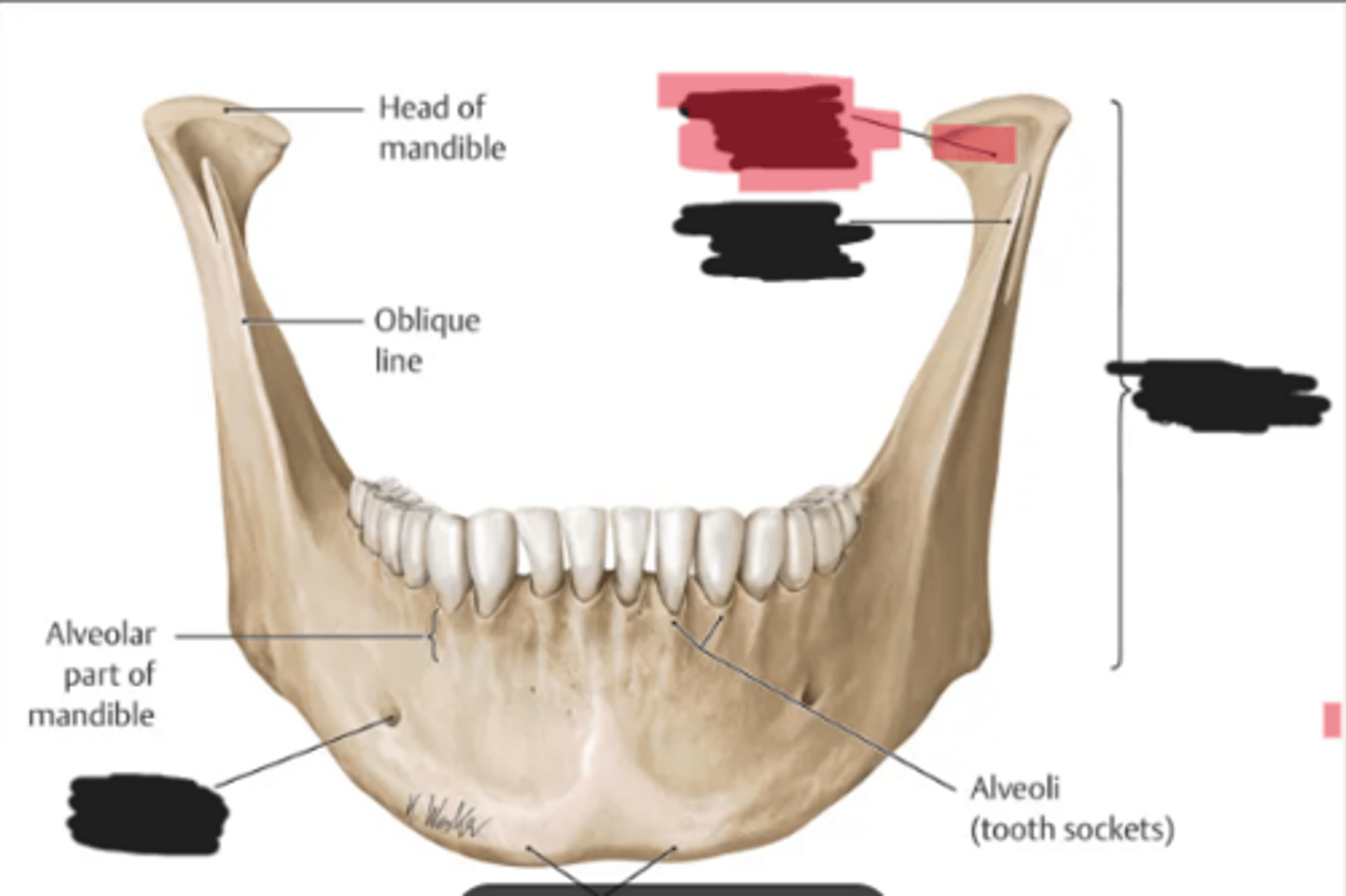 <p>Condylar process of the mandible</p>