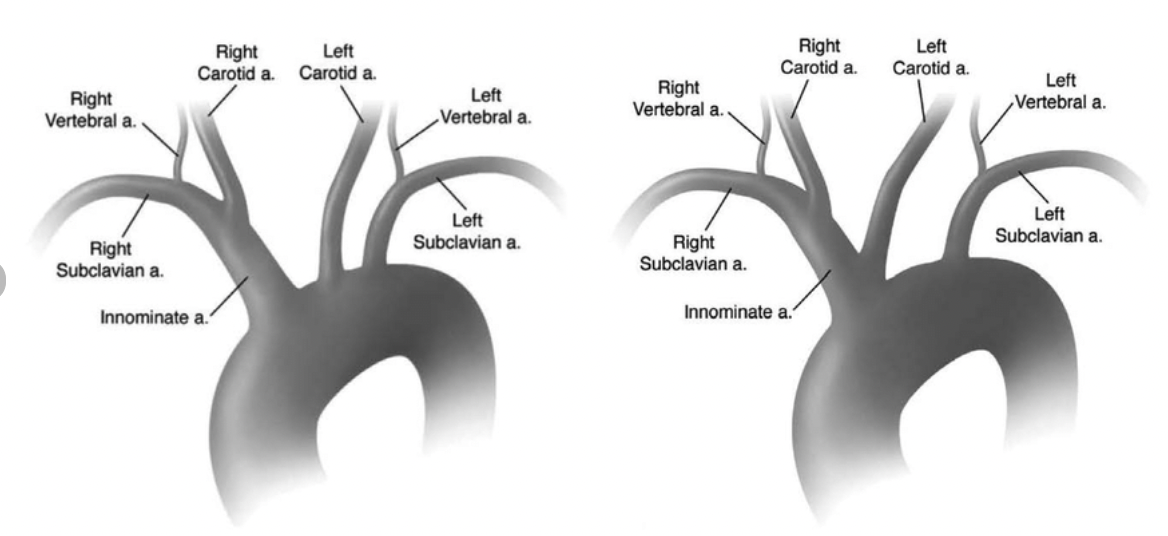 <p>What is the Bovine arch? </p>