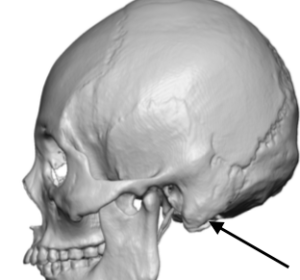 in temporal bone