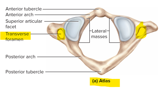 <p>C1 - supports the head; has no body; articulates with the occipital condyles; allows us to make the “yes” movement </p>