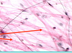 <p>Structure: Collagen, fibroblasts, and ground substance</p>