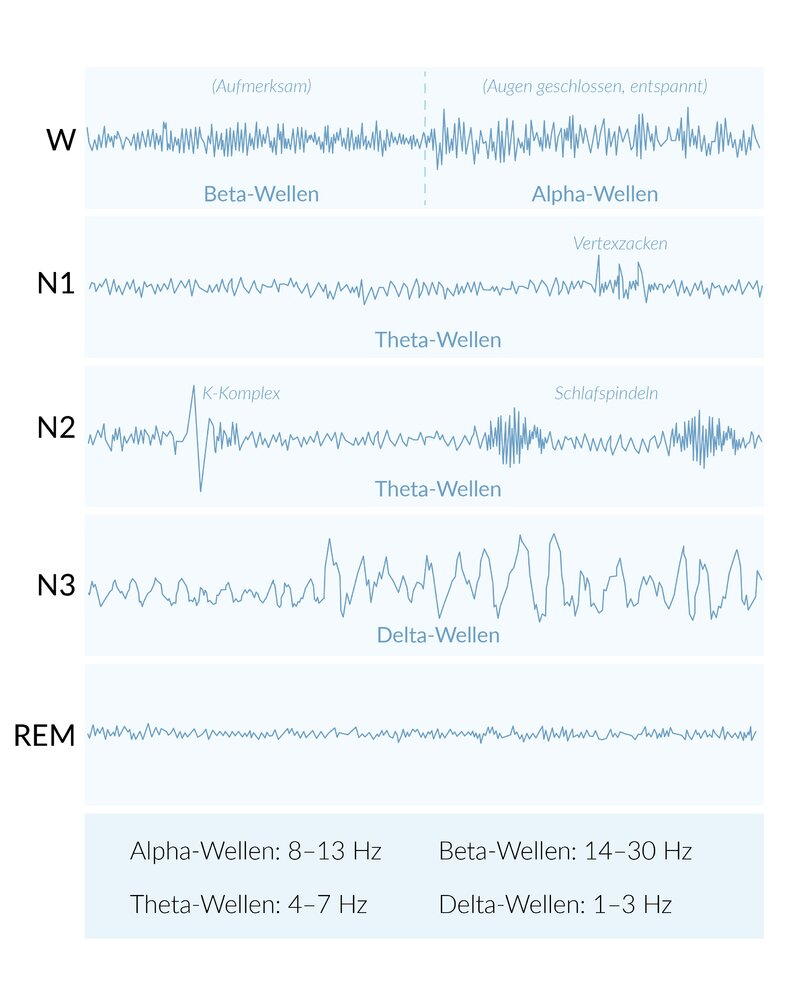 <p>A. In the falling-asleep phase (sleep stage I / N1 stage), θ (theta) waves appear in the EEG.</p>